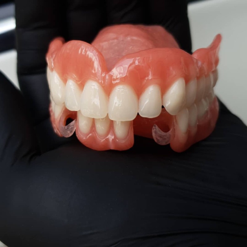 ساخت دندان مصنوعی با کمترین اذییت
