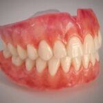 ساخت دندان مصنوعی با کمترین اذییت